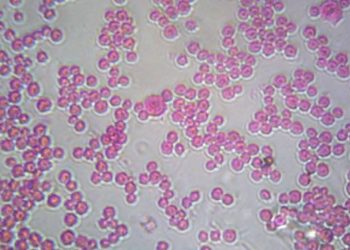 découvrez toutes les informations sur le remboursement du vaccin bexsero pour les jeunes. apprenez comment bénéficier de cette couverture santé, les conditions à respecter et les démarches à suivre pour assurer la protection de vos enfants contre les méningites.